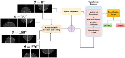 Enhancing brain tumor detection in MRI with a rotation invariant Vision Transformer